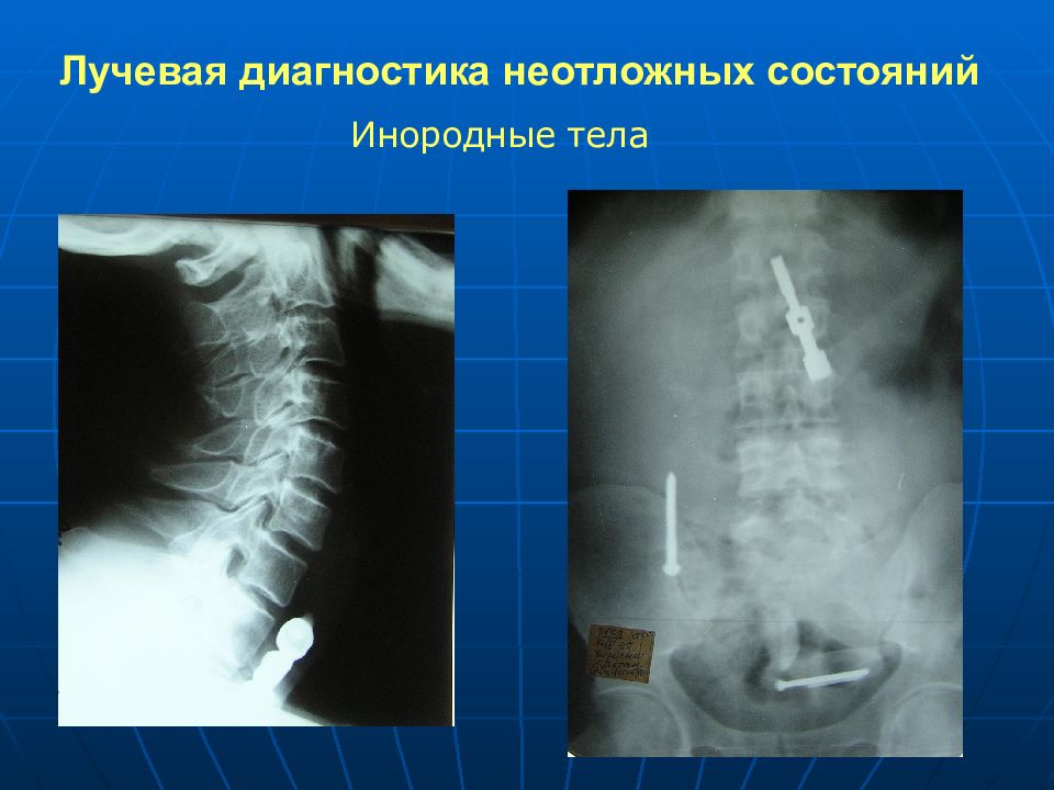 Лучевая диагностика заболеваний жкт презентация