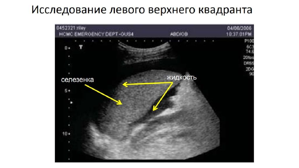 Новик узи. Неотложная ультразвуковая диагностика. Ультразвуковая диагностика неотложных состояний. УЗИ В неотложных состояниях. Ультразвуковая диагностика неотложных состояний презентация.