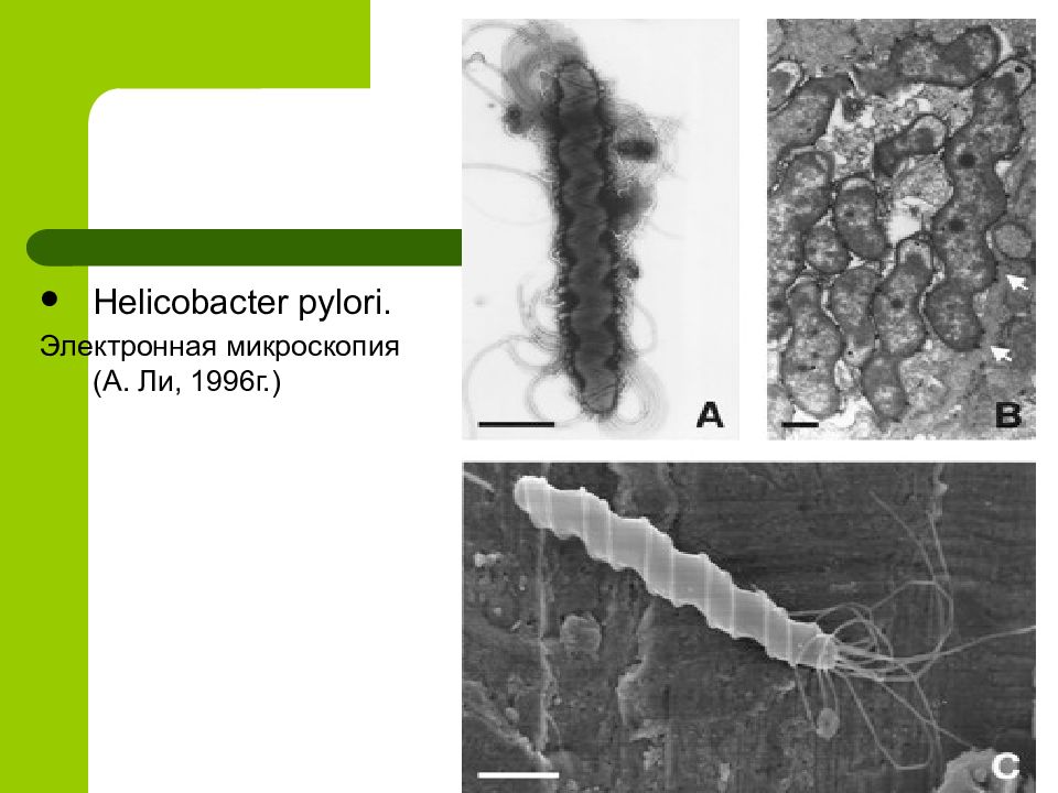 Как выглядит хеликобактер пилори под микроскопом фото