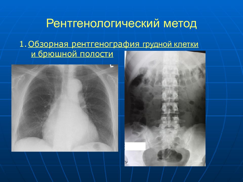 Рентген брюшной полости фото норма