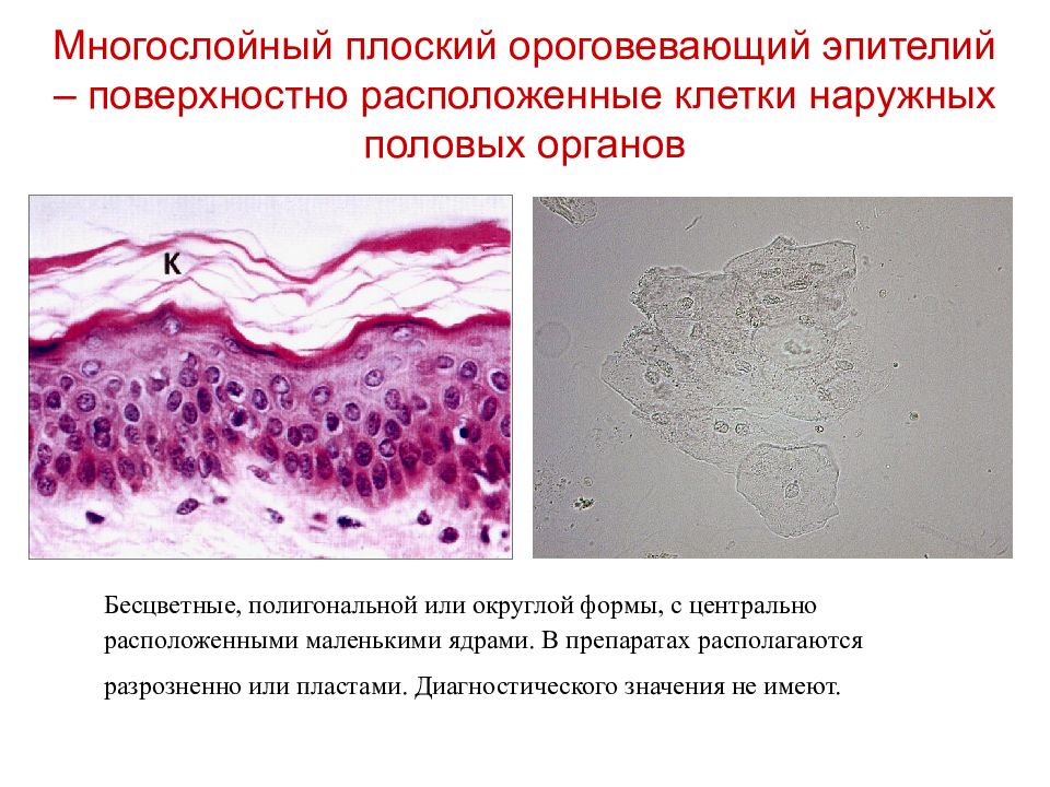 Многослойный плоский ороговевающий эпителий рисунок