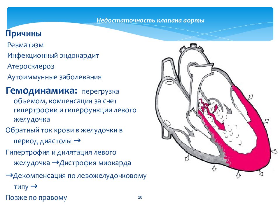 Минимальная аортальная регургитация. Аортальная недостаточность гемодинамика схема. Пороки сердца схема митральная недостаточность аортальная. Недостаточность артериального клапана 1 степени. Недостаточность аортального клапана рисунок.