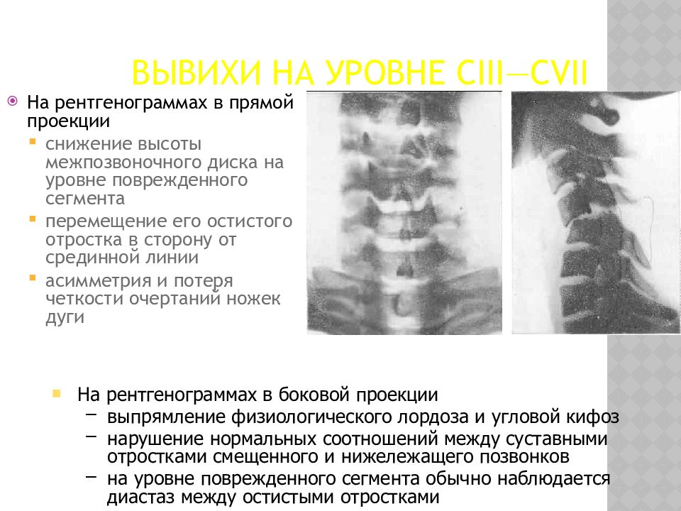 Лучевая диагностика позвоночник презентация