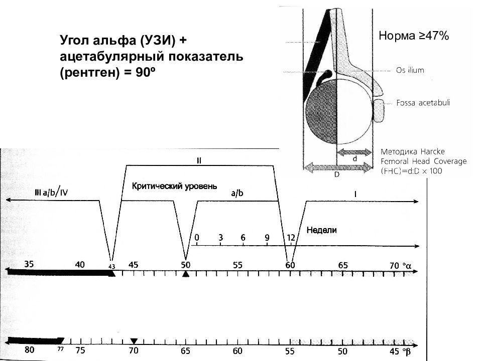 Норма углов. Ацетабулярный угол у детей норма по возрастам таблица. Ацетабулярные углы у детей норма. Ацетабулярный угол у детей норма таблица. Ацетабулярный угол у детей норма по возрастам.