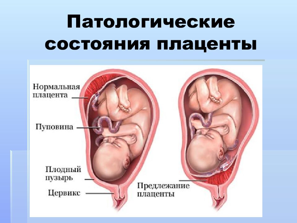 Подпишите самостоятельно на рисунке следующие органы плацента пуповина матка