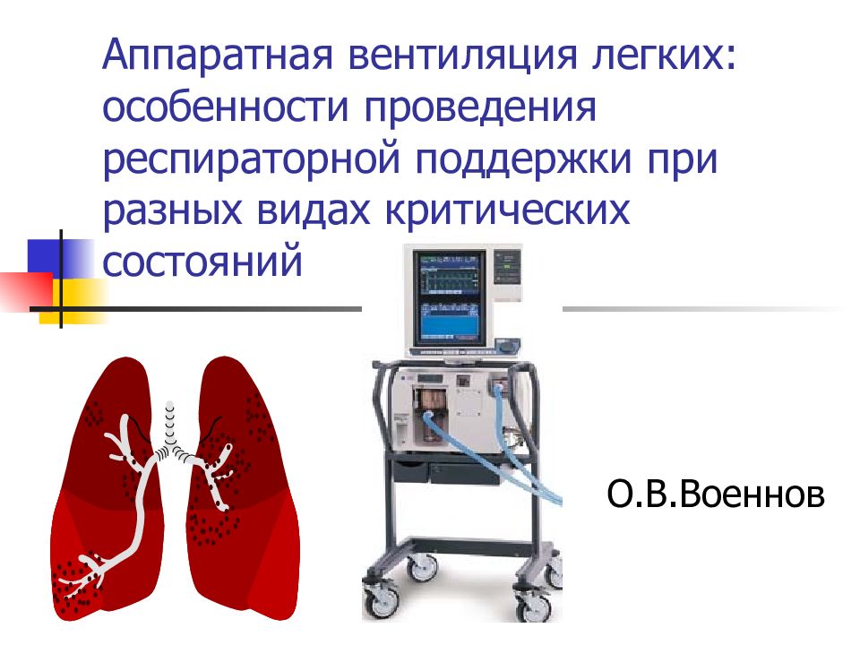 Особенности легких. Вентиляция легких. Сигналы тревоги в реанимации. Сигналы тревоги аппарат ИВЛ. Гипер вент вентиляция легких.