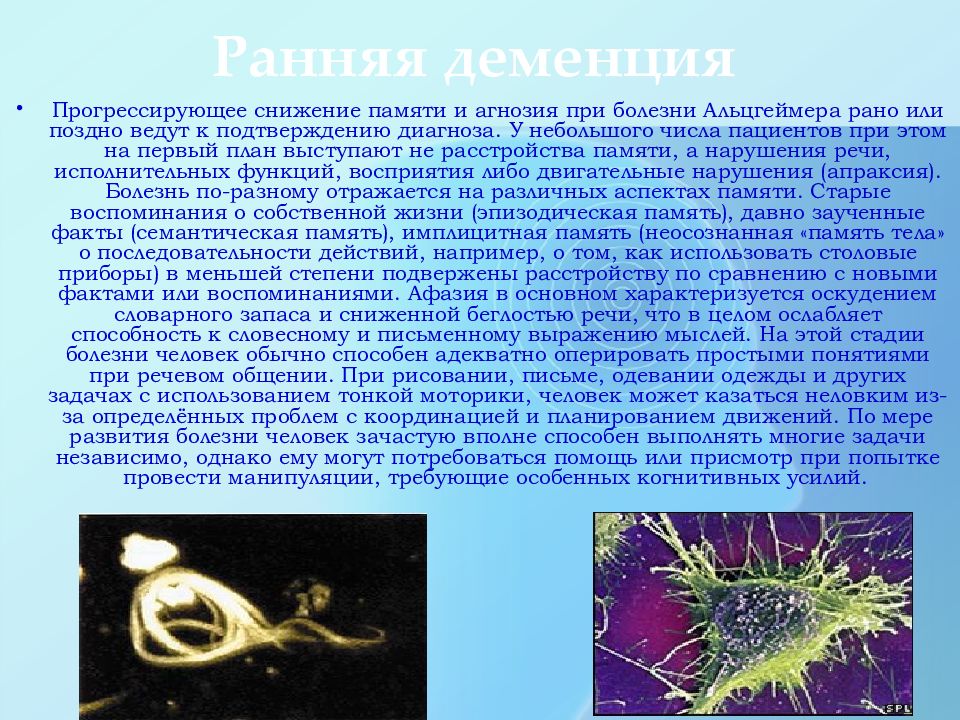 Презентация про болезнь альцгеймера