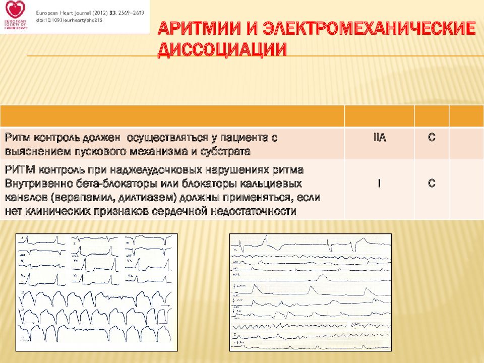 Наджелудочковая тахикардия карта вызова смп