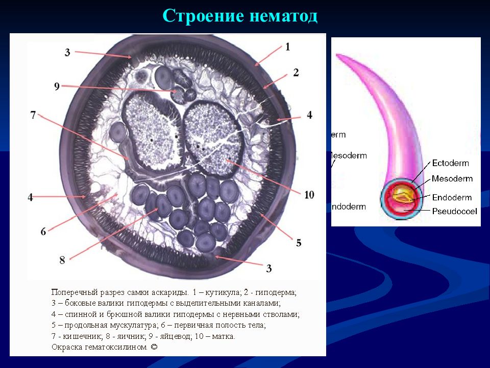 Поперечного строения. Поперечный срез самки аскариды с обозначениями. Поперечный срез тела аскариды. Поперечный срез аскариды препарат. Поперечный срез самки аскариды.