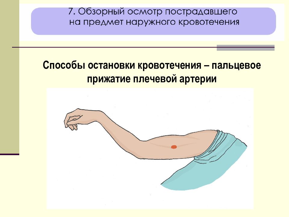 Плечевая артерия кровотечение. Прижатие плечевой артерии. Пальцевое прижатие артерий. Плечевая артерия первая помощь.