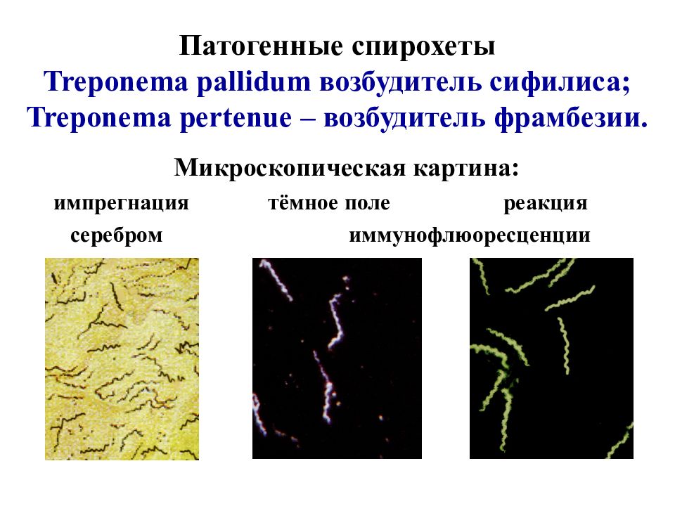 Спирохеты микробиология презентация