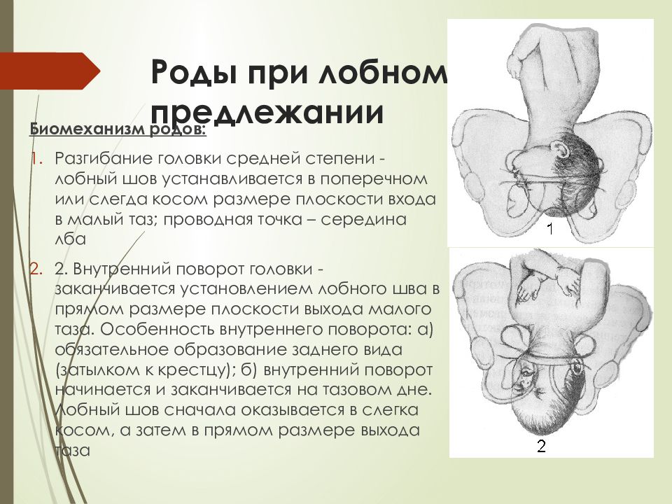 Разгибательные вставления головки плода презентация