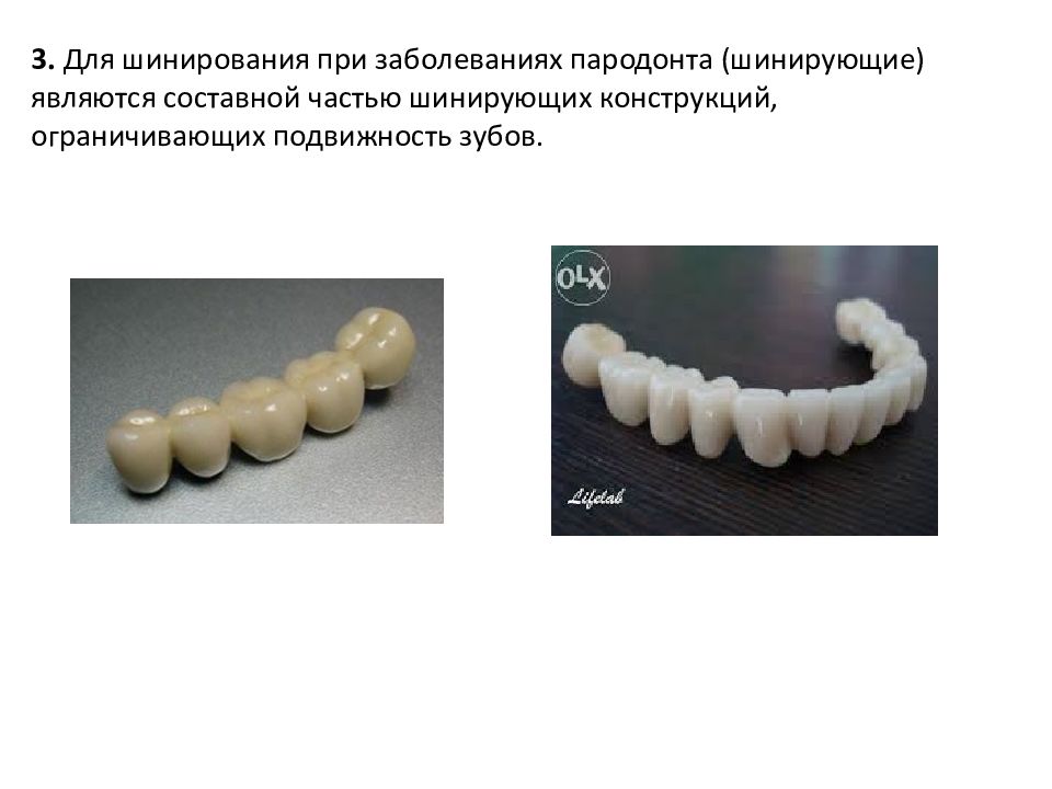 Пластмассовые коронки презентация