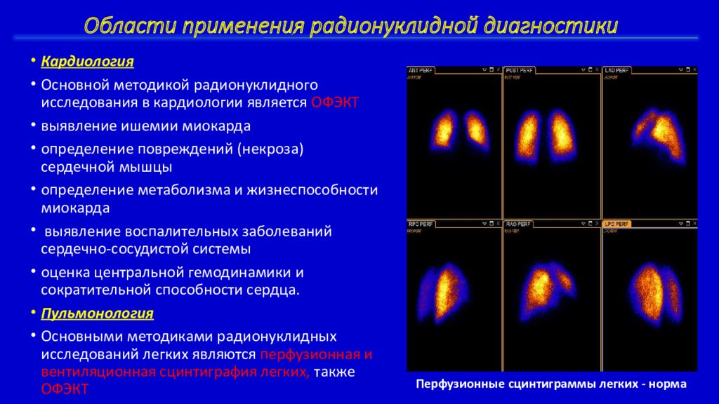 Спектр диагноз. Радионуклидная диагностика заболеваний. Радионуклидные методы исследования сердца. Радионуклидная диагностика сердечно сосудистой системы. Радионуклидная диагностика преимущества и недостатки.