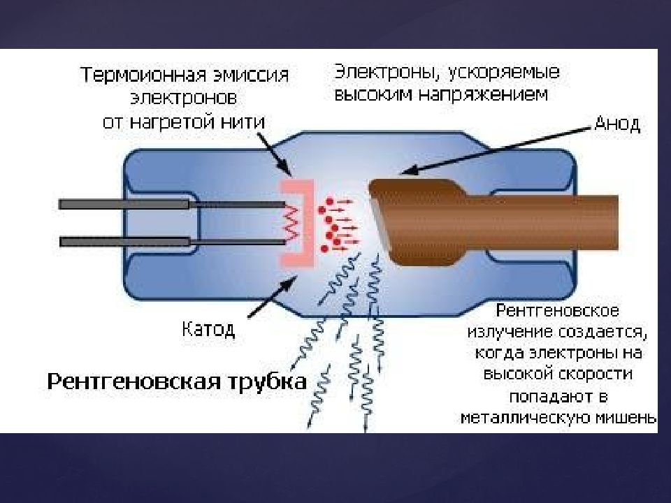 Схема рентгеновской трубки принцип работы. Устройство и принцип работы рентгеновской трубки. Схема устройства рентгеновской трубки. Рентгеновская трубка строение принцип работы.