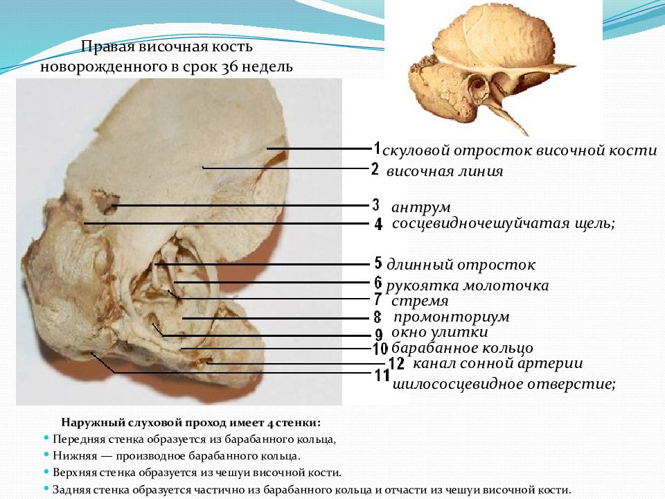 Височный отросток