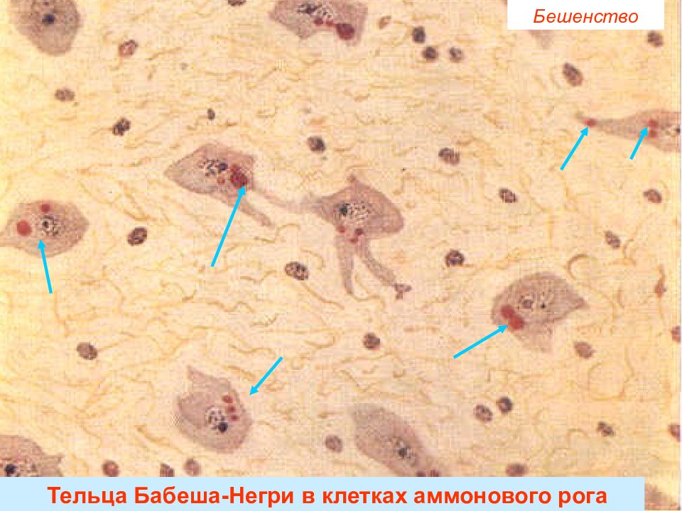 Тельца негри. Тельца Бабеша негри под микроскопом. Вирус бешенства тельца Бабеша негри. Тельца Бабеша негри препарат.