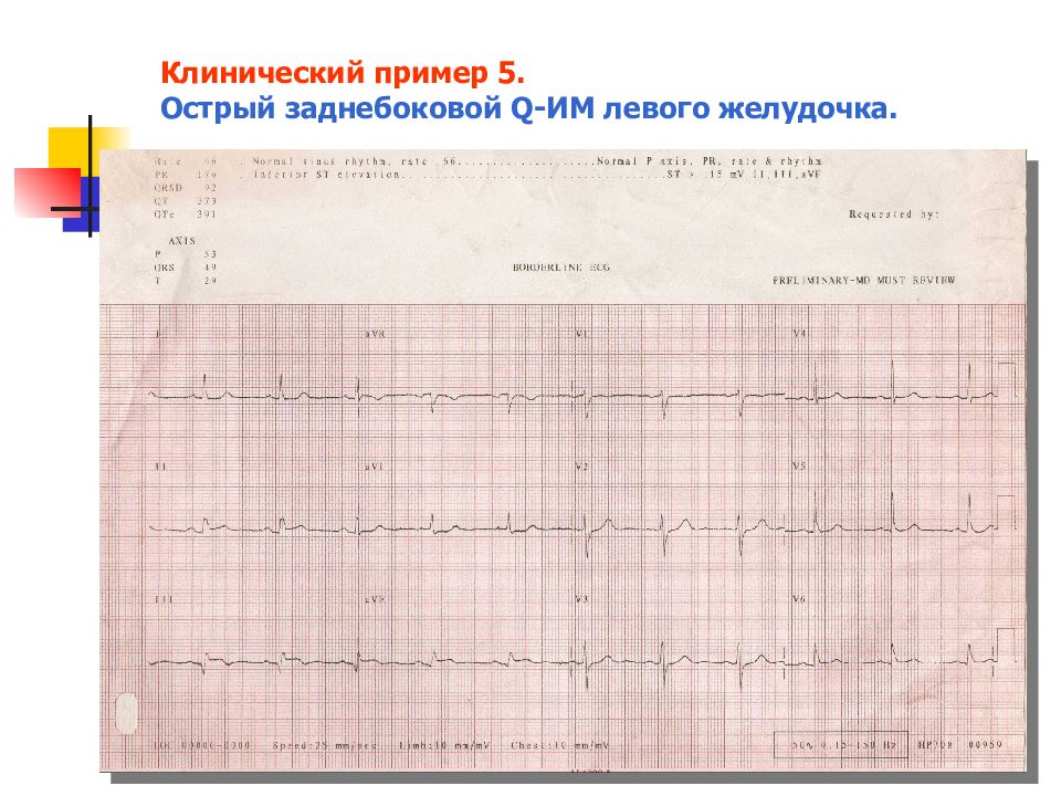 Ибс пропедевтика внутренних болезней презентация