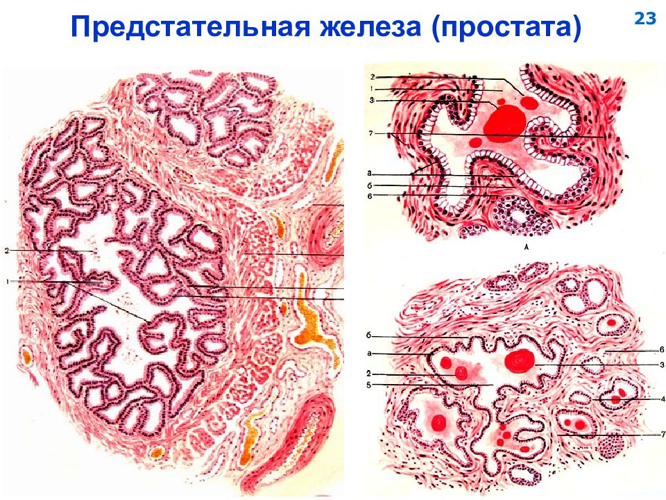 Простата гистология рисунок