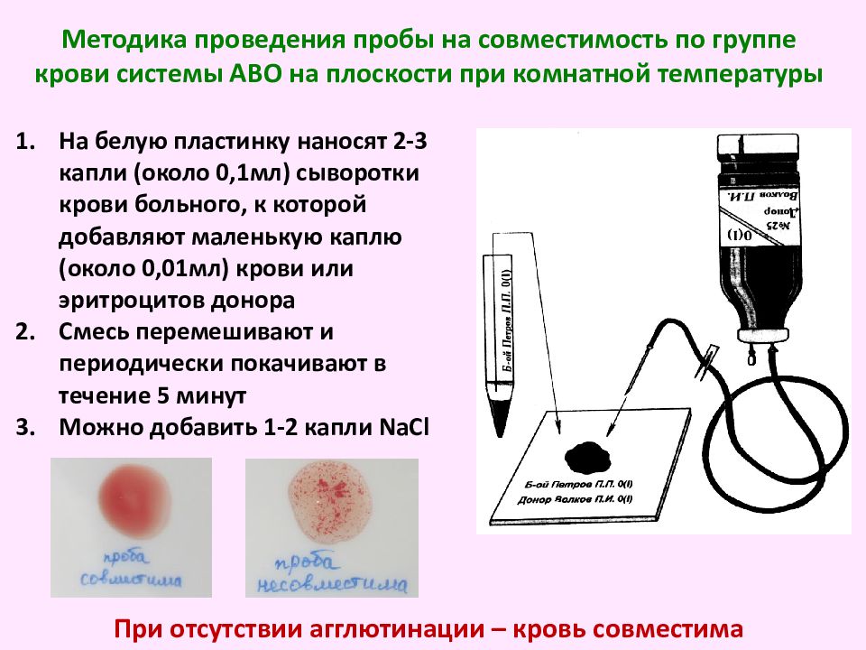 Какая из предложенных схем совместимости крови при переливании правильная почему