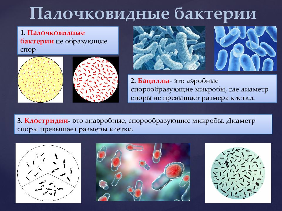 Какие микроорганизмы существуют. Палочковидные формы микроорганизмов микробиология. Формы бактерий палочковидные бациллы. Палочковидными (бациллы, клостридии). Палочковидные (цилиндрические) формы бактерий.