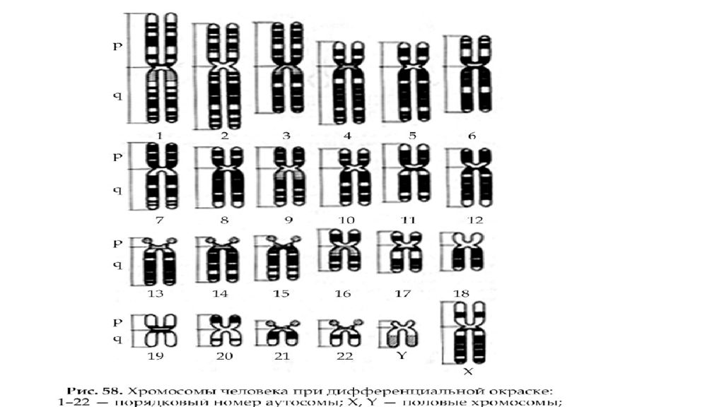 Парижская хромосома. Парижская классификация хромосом. Парижская классификация хромосом человека. Денверская и Парижская классификация хромосом. Парижская номенклатура хромосом человека.