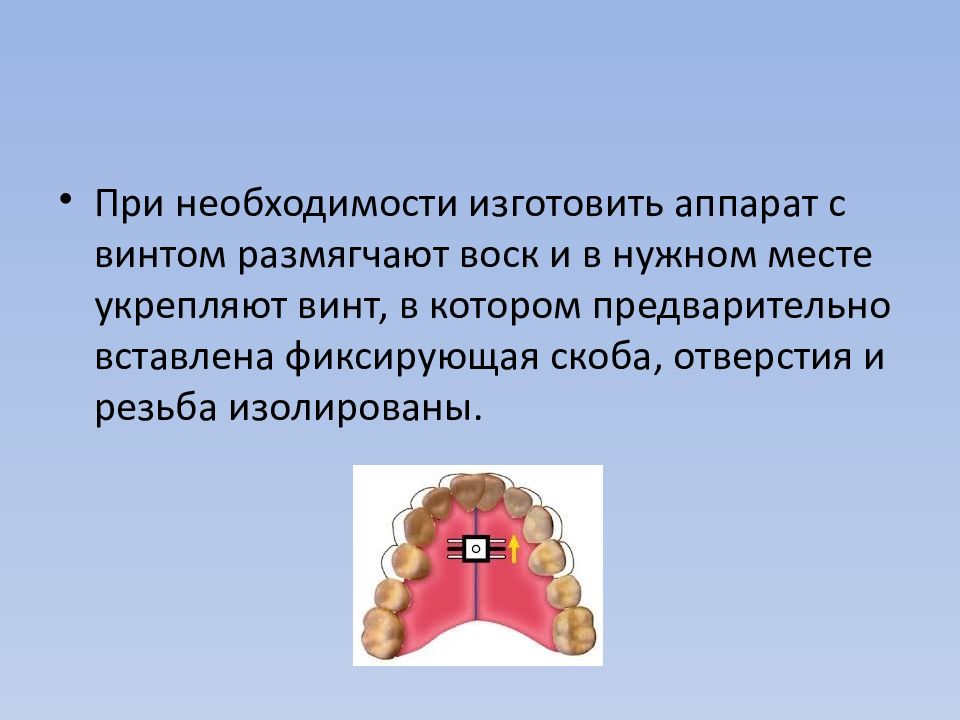 Ортодонтические аппараты механического действия презентация