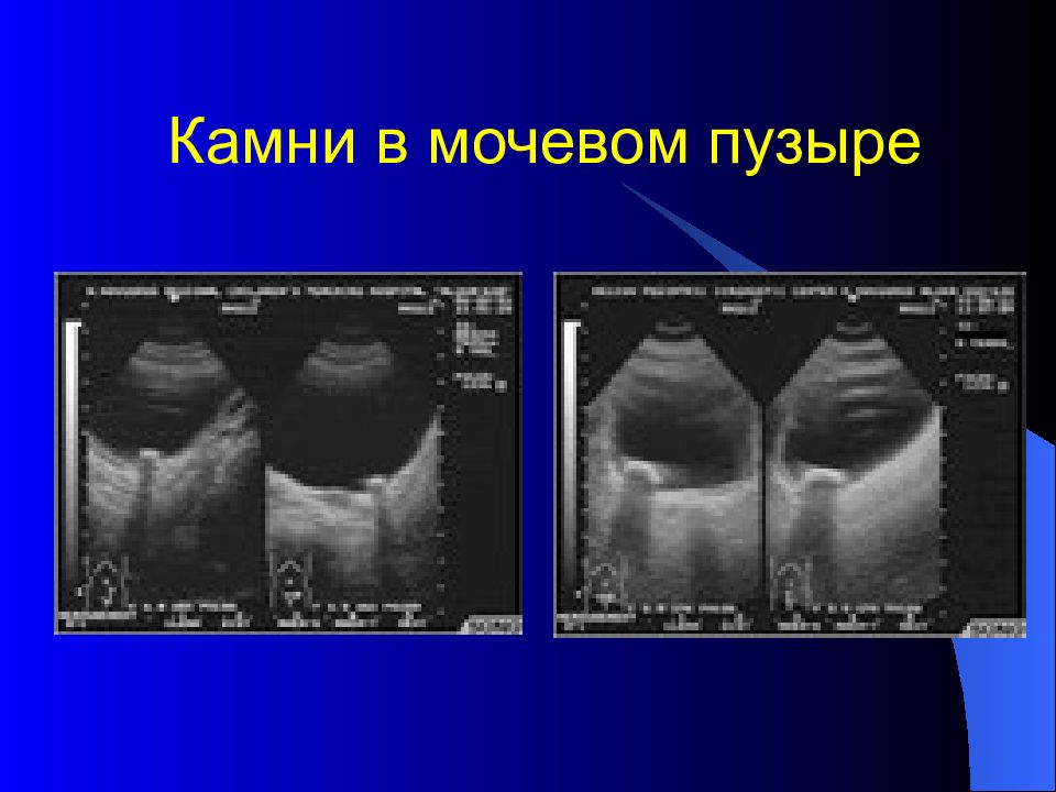 Лучевая диагностика брюшной полости презентация