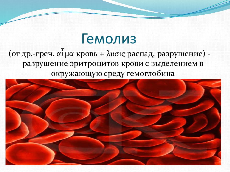 Распад эритроцитов. Гемолиз эритроцитов в крови. Гемолиз эритроцитов лаковая кровь. Признак гемолизированной крови плазма. Гемолизированные эритроциты гистология.