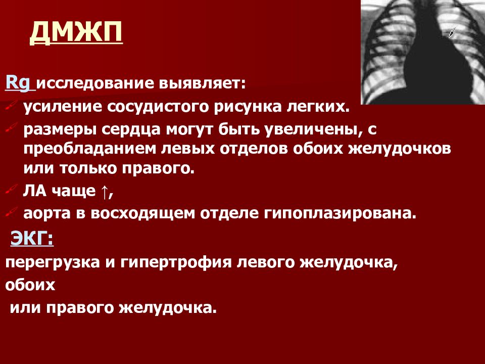 Клинические рекомендации врожденные пороки сердца у детей. Дефект межжелудочковой перегородки клинические рекомендации. Дефект межжелудочковой перегородки сердца. Дефект межжелудочковой перегородки осмотр.