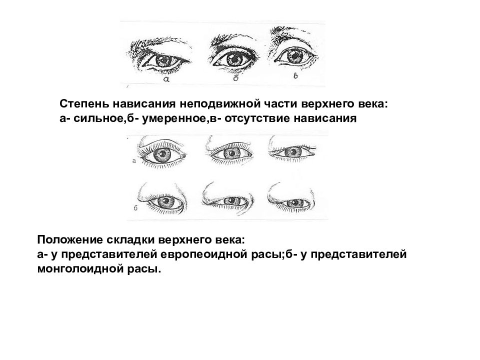 Положение век. Положение верхнего неподвижного века. Стадии нависание верхнего века. Складка верхнего века антропология. Нависание верхнего века криминалистика.