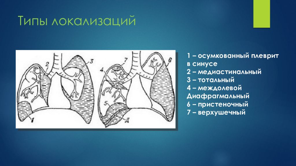 Плевра эмпиемасы презентация казакша