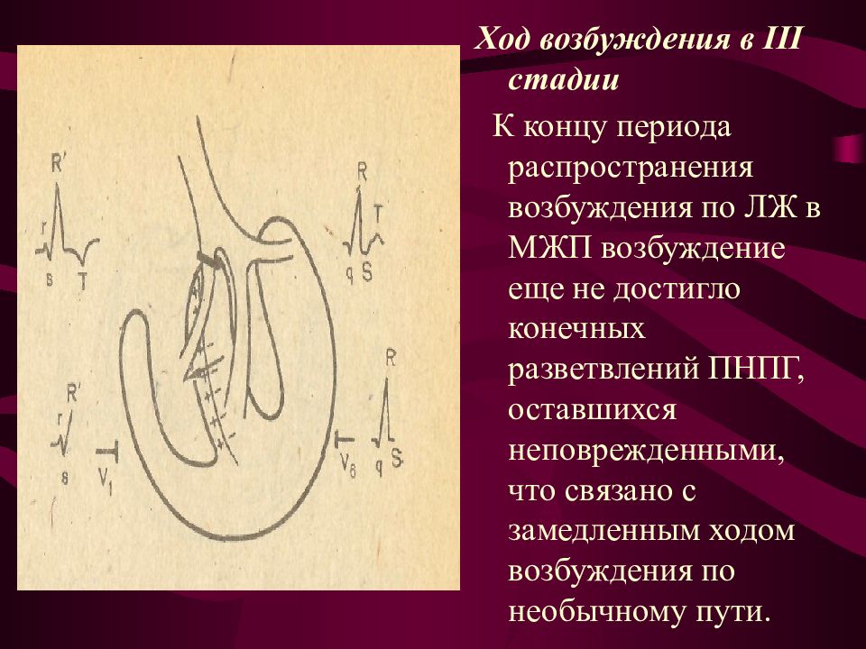 Возбуждение члена. Возбуждение межжелудочковой перегородки. Возбуждения по ПНПГ. Фазы распространения возбуждения. Замедление хода возбуждения по правой ножке пучка Гиса.