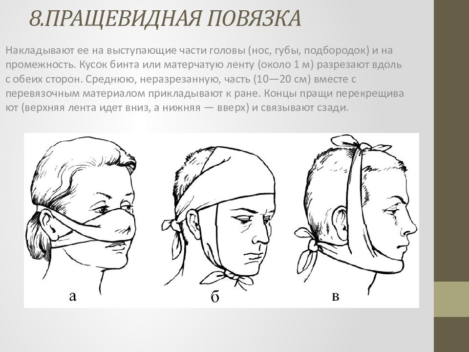 Пращевидная повязка рисунок