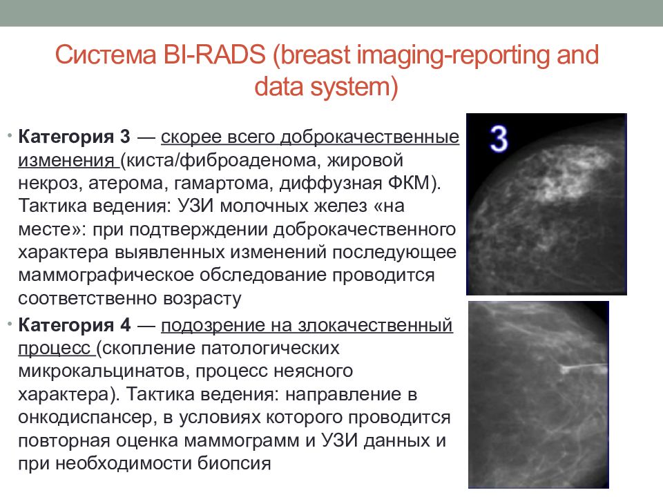 Rads 3 что это значит. Фиброаденома молочной железы bi-rads 3. Bi-rads 3 молочной железы маммограмма. Birads 2 молочной железы что это такое. Классификация birads маммография.