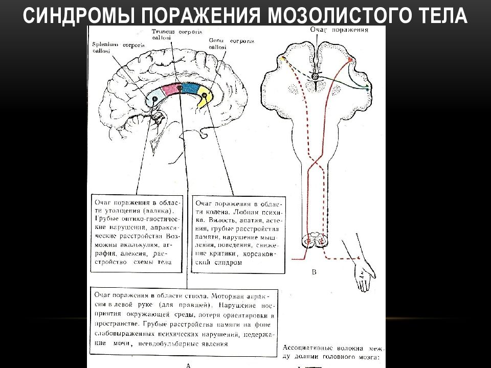 Мозолистое тело функции