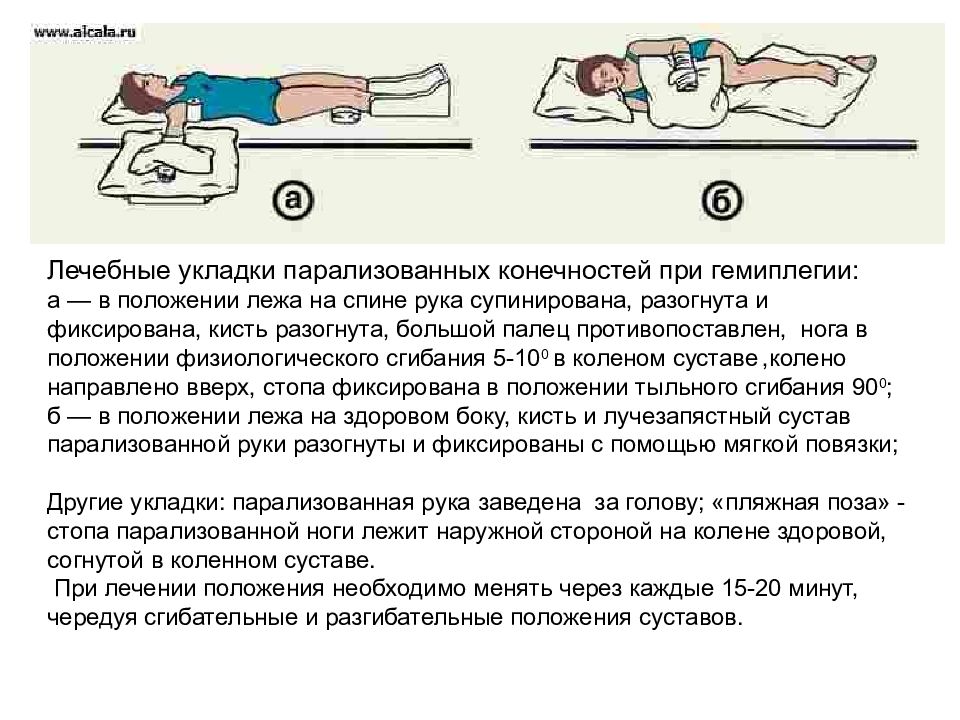 Правильное ли положение больного с инсультом приведенное на рисунке