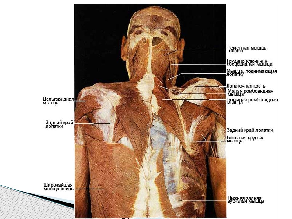 Фиброз мышц лечение. Анатомические разрезы на спине.
