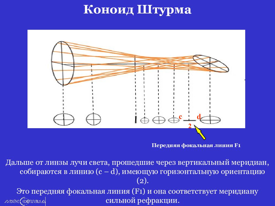 Далее после. Коноид штурма астигматизм. Коноид штурма фокальные линии. Коноид штурмана. Передняя фокальная линия схема.