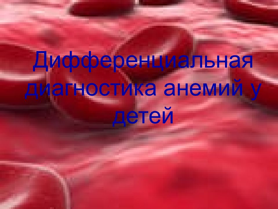 Дифференциальная диагностика анемий у детей