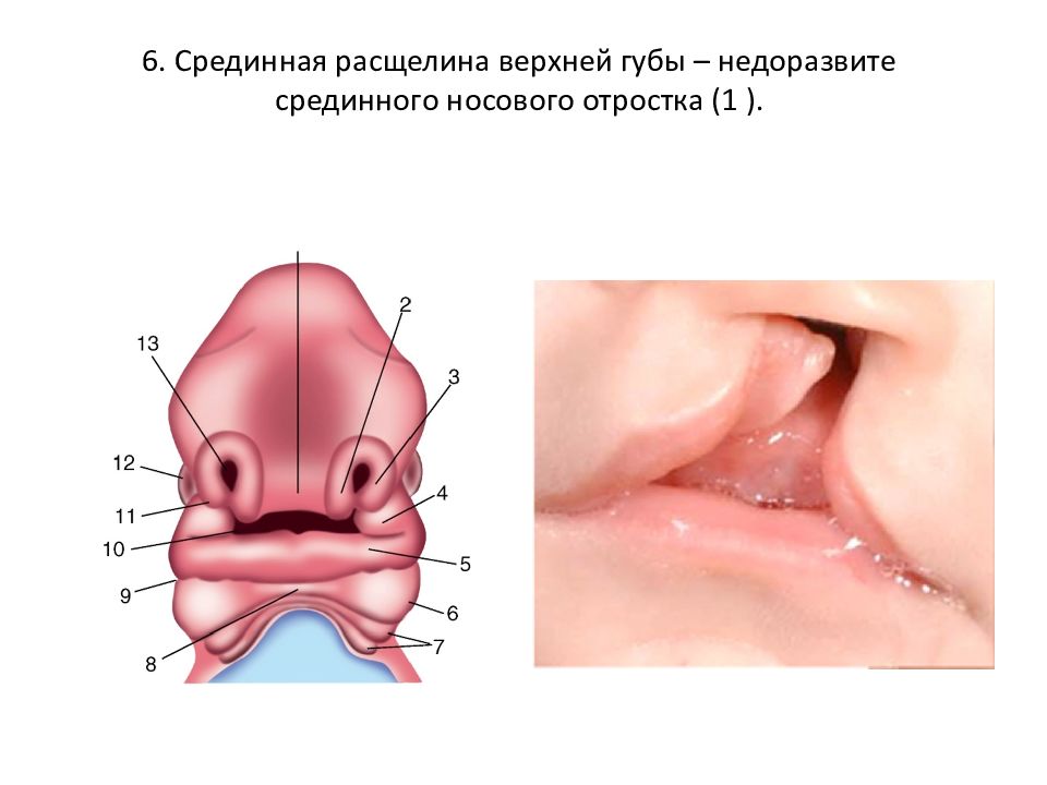 Расщелина Мягкого Неба Фото