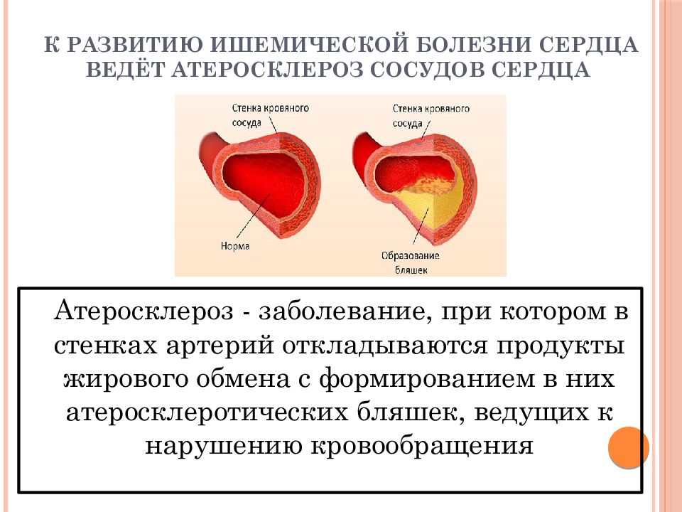 Ишемия мышц. Атеросклеротическая болезнь болезнь сердца. Симптомы атеросклеротического поражения сосудов миокарда. Ишемическая болезнь сердца симптомы. Факторы вызывающие ишемическую болезнь сердца.