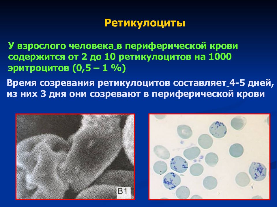 Ретикулоциты это. Ретикулоциты в периферической крови. Ретикулоциты в периферической крови в норме. Норма ретикулоцитов в периферической крови. Ретикулоциты 2%.