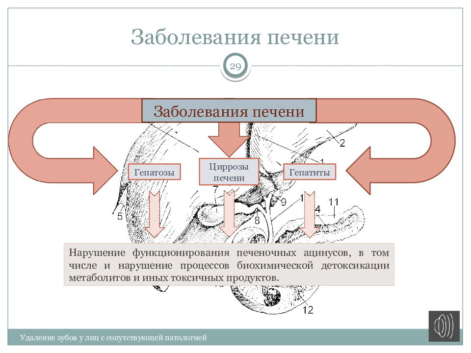 Заболевания печени хирургия презентация