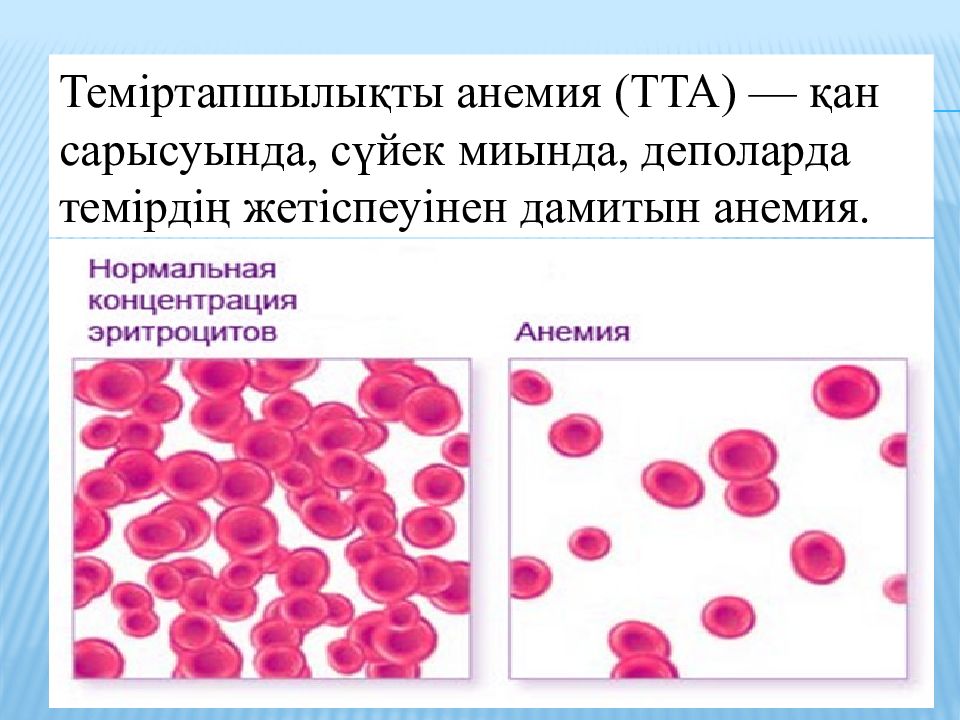 Анемия презентация по педиатрии