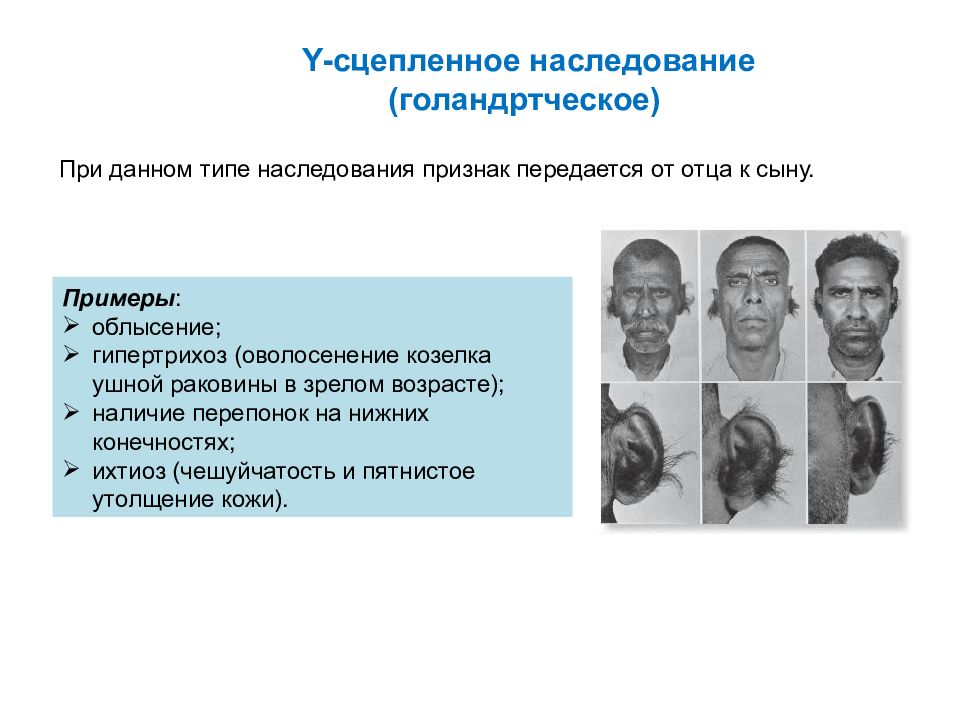 Х сцепленные признаки. Наследование гипертрихоз Тип наследования. Y-сцепленный Тип наследования болезни. Голандрический Тип наследования болезни. Y сцепленное наследование признаки.