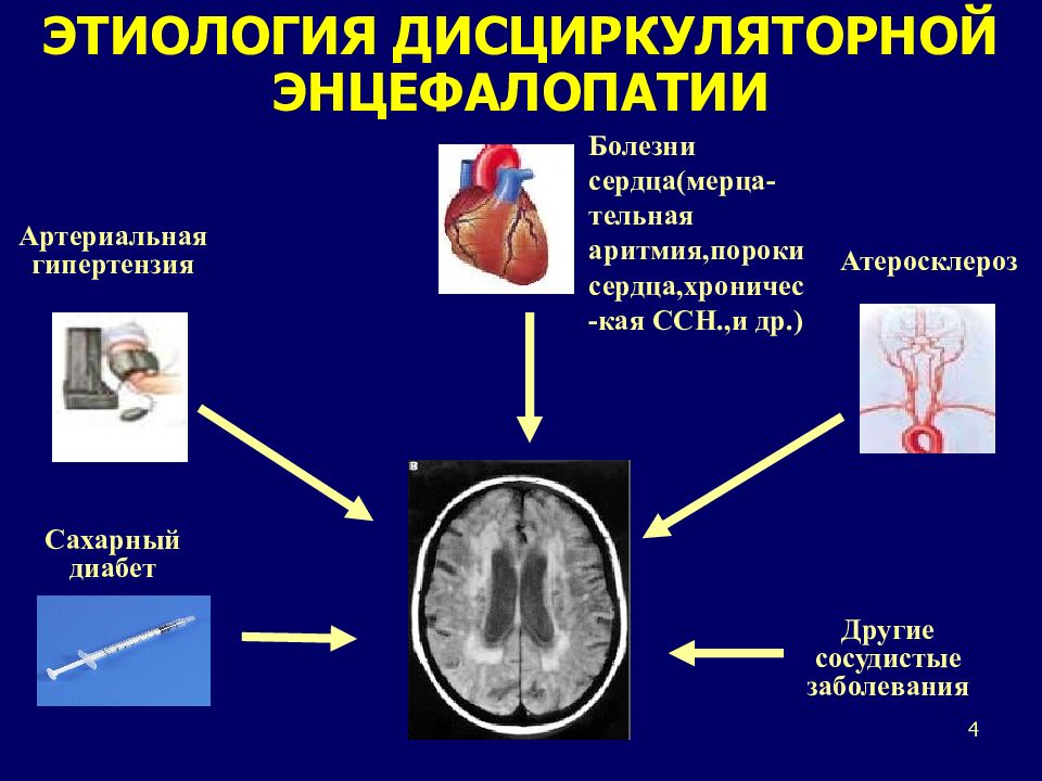 Дисциркуляторная энцефалопатия презентация