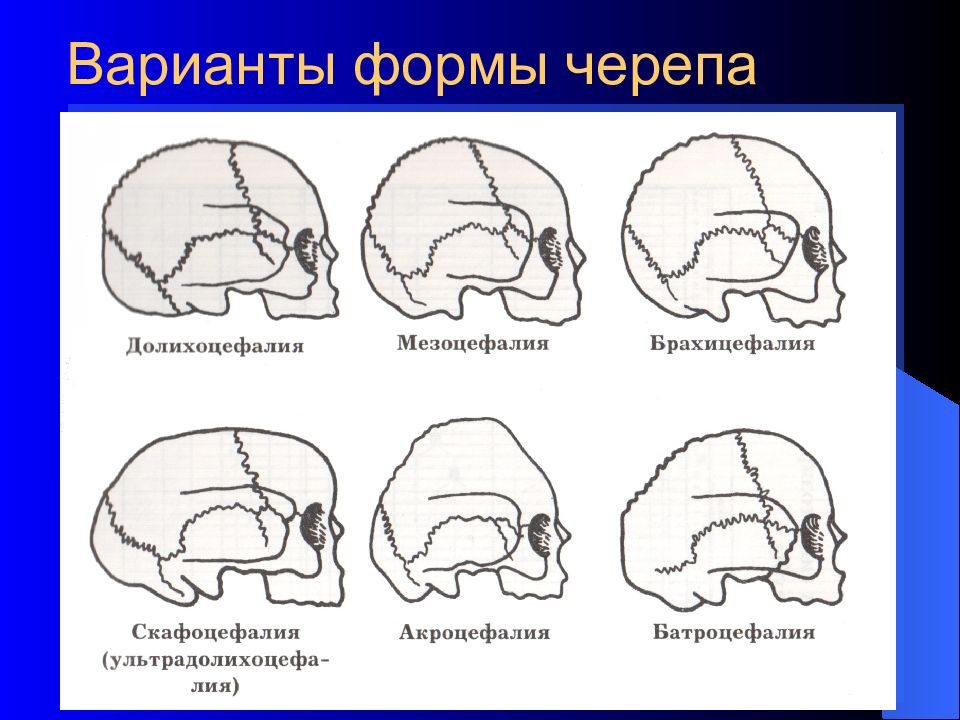 Формы черепа. Мезоцефалия форма головы. Формы головы человека брахицефалия, мезоцефалия. Формы черепа брахицефал долихоцефал. Мезоцефалический Тип строения черепа.