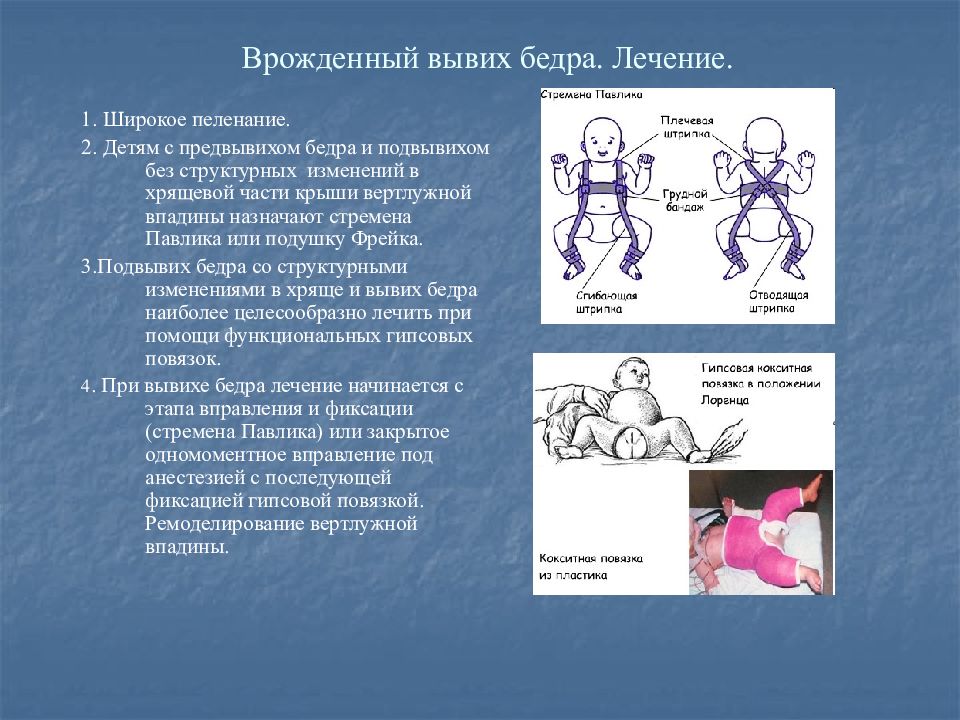 Растяжение связок бедра лечение