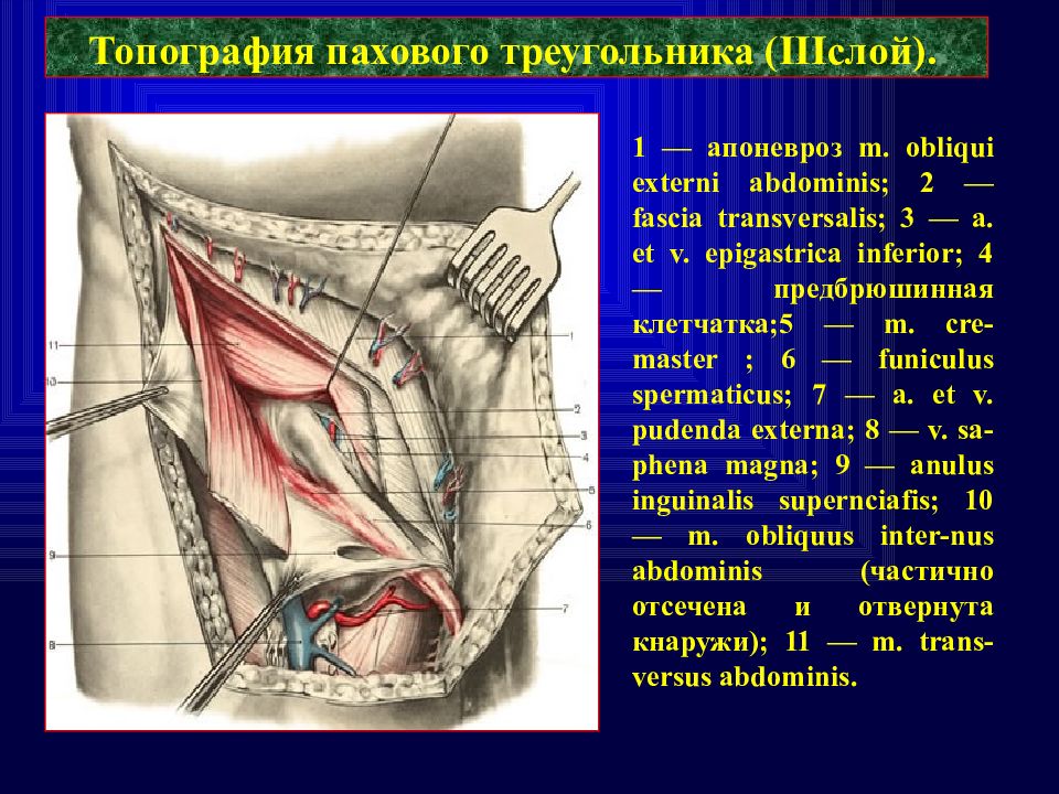 Паховый канал. Стенки пахового канала топографическая анатомия. Паховая область топографическая анатомия. Топография пахового треугольника. Передняя стенка пахового канала образована.